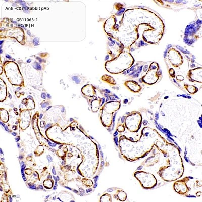 Anti-CD31 Arnab Pab